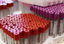 Santé : 5 bonnes raisons de connaître son Groupe Sanguin